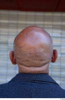  Street  823 bald head 0003.jpg